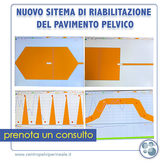 PHENIX - IL NUOVO SISTEMA DI RIABILITAZIONE DEL PAVIMENTO PELVICO - Dott. Carmelo GEREMIA - Specialista in Gastroenterologia